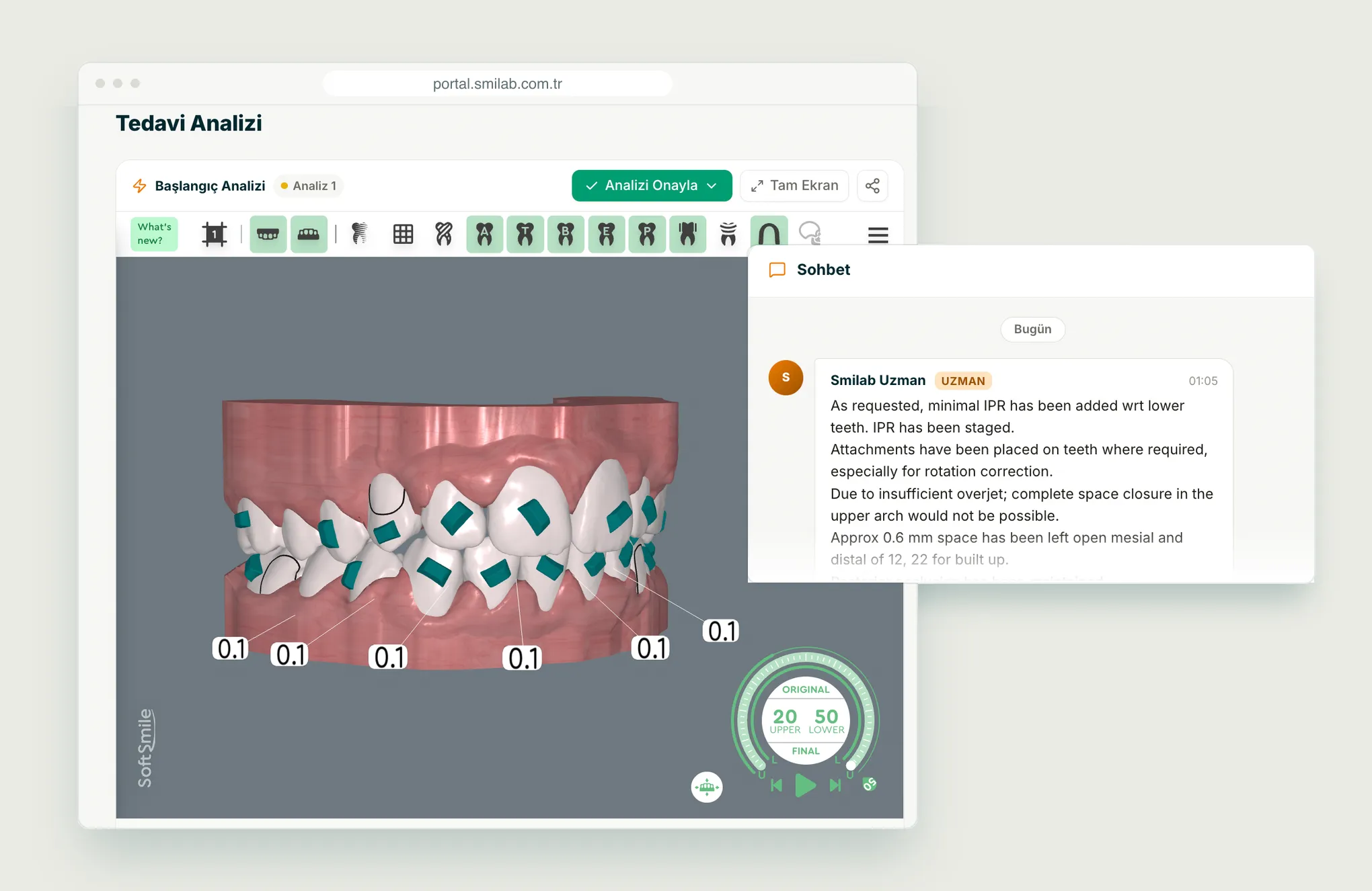 3D tooth model and case chat with an expert in the Smilab portal