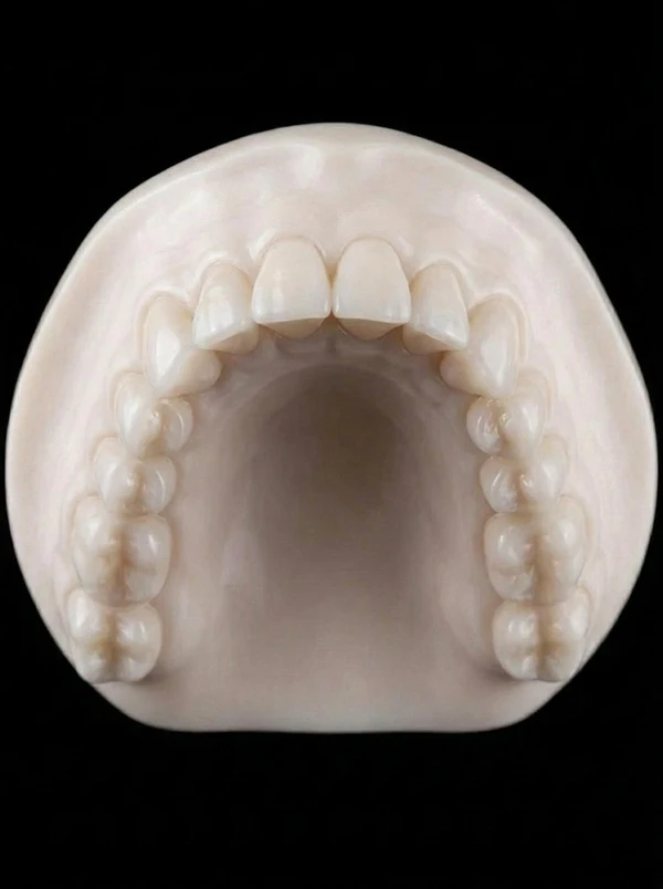 Example photo framing: upper arch